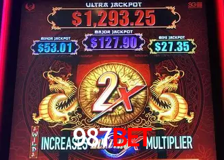 987bet Rio de Janeiro - Professional Dealers